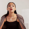 Dulu Tutupi Vitiligo Pakai Stoking dan Foundation, Zsazsa Caesar Kini Jadi Model Inspiratif