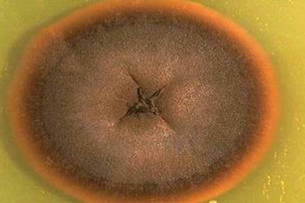 Jamur Exophiala dermatitidis