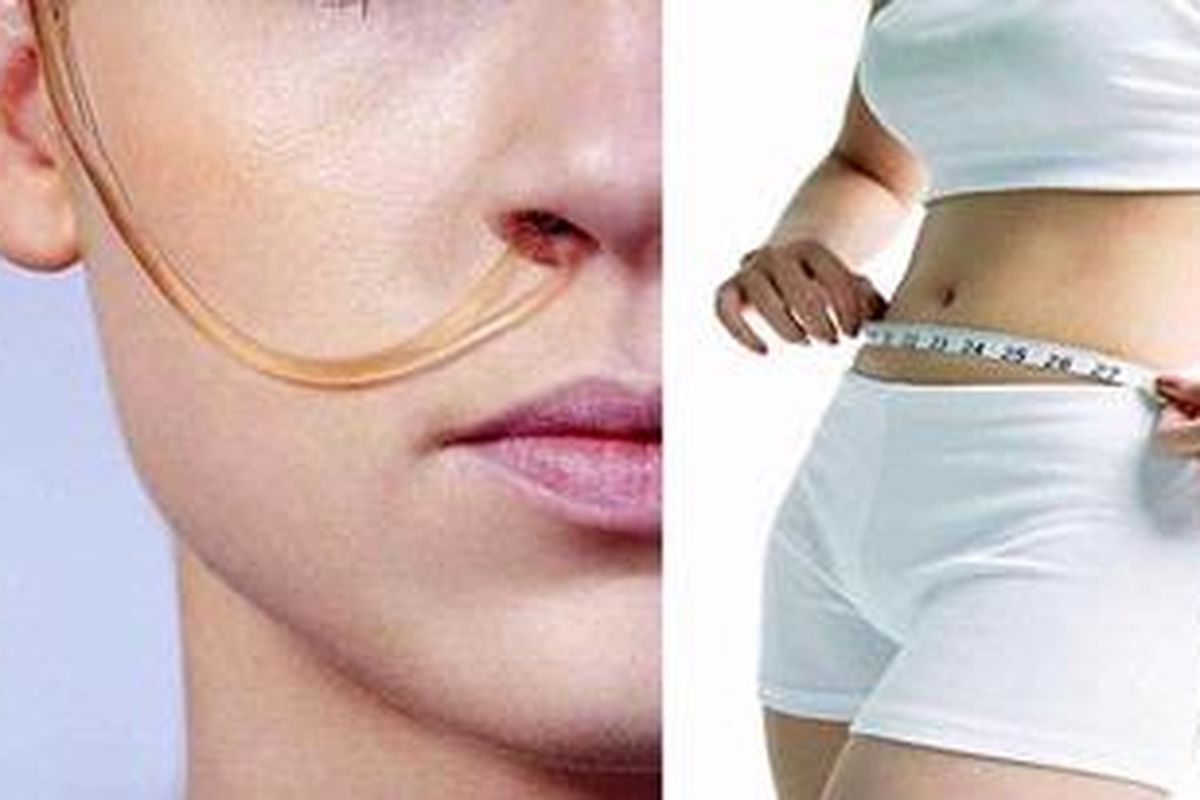 KEN diet menggunakan saluran mirip infus di bagian hidung sampai ke perut untuk mengalirkan formula makanan diet. 