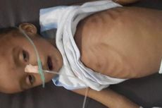 Rizky Bayi 2 Tahun Sekarat, Tak Ada Biaya Perawatan