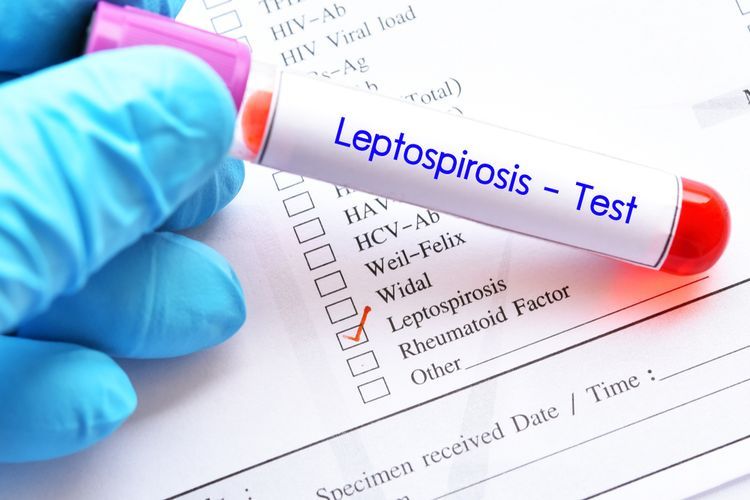 Tanda gejala penyakit leptospirosis.