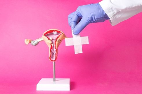 12 Tanda-tanda Miom pada Wanita dan Kapan Perlu ke Dokter