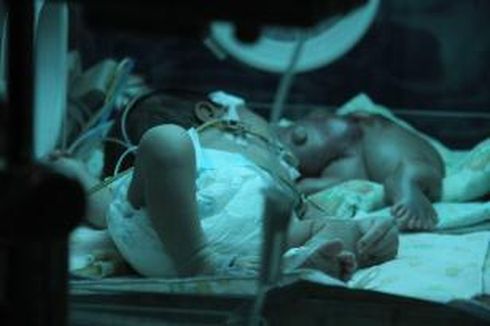 Kenapa Bayi Ginan Disebut Kembar Parasit ?