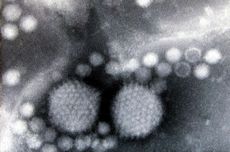 CDC Ungkap Bukti Infeksi Adenovirus Sebabkan Hepatitis Akut Misterius pada Anak