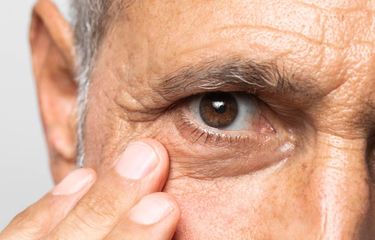 Ilustrasi risiko komplikasi retinopati diabetik.