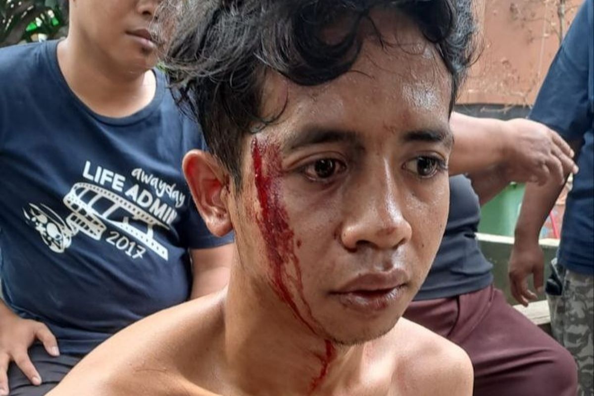 Seorang warga bernama Ridho yang menjadi korban amuk warga karena dikira maling di Jalan Haji Jian II, Cipete Utara, Kebayoran Baru, Jakarta Selatan, sekitar pukul 16.00 WIB pada Selasa (25/7/2023). 