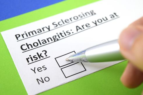 Primary Sclerosing Cholangitis