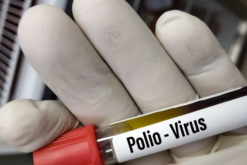 Penderita Polio di Purwakarta Tak Terima Imunisasi Lengkap karena Takut