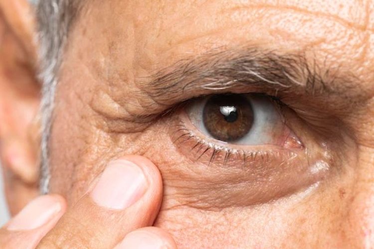 6 Faktor Yang Meningkatkan Risiko Retinopati Diabetik, Apa Saja?