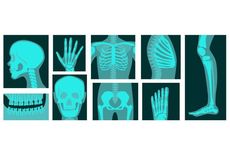 5 Mitos Salah Seputar Tulang dan Sendi