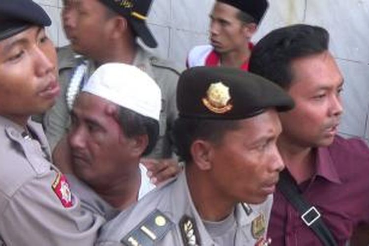 Mat Sarep mengalami bengkak di dahinya setelah dipukuli warga karena dituduh mencopet.