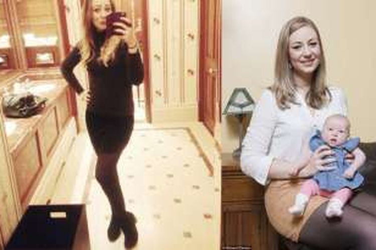 Klara Dollan, foto kiri ketika ia hamil 7 bulan, dan foto kanan setelah melahirkan.