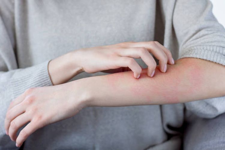 Ilustrasi kulit gatal. Kulit gatal adalah salah satu gejala yang bisa dirasakan oleh penderita penyakit autoimun yang menyerang kulit. 