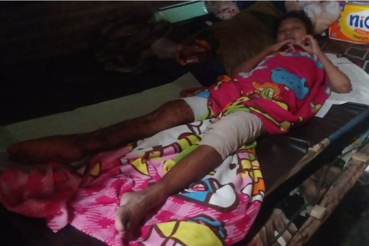 Kondisi Retno Arum Wulan Safitri yang hanya bisa tergolek lemah di atas ranjang bambu dirumahnya selama 6 bulan.