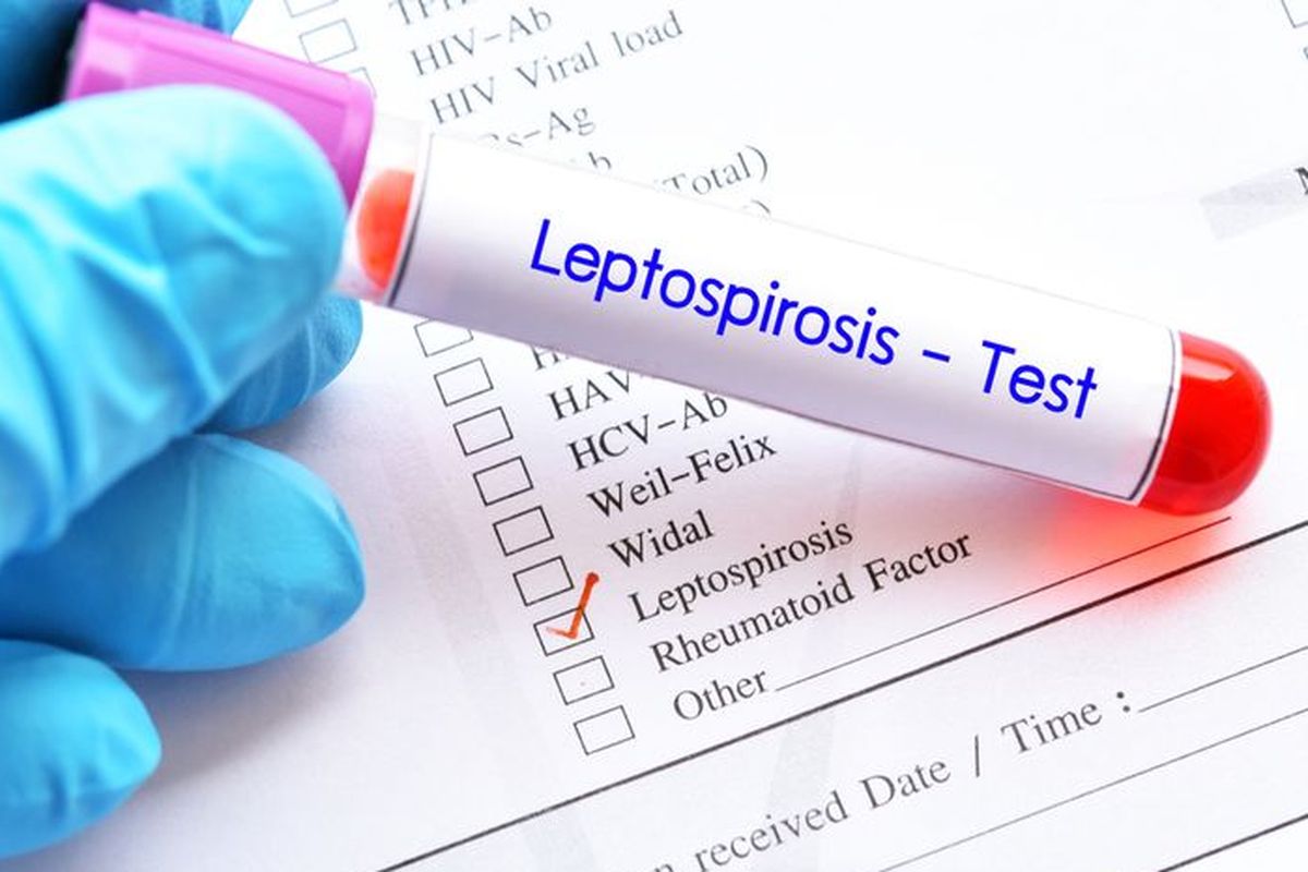 Seorang pemuda Iran alami komplikasi berat akibat leptospirosis, yang memicu rhabdomyolysis dan gagal ginjal.