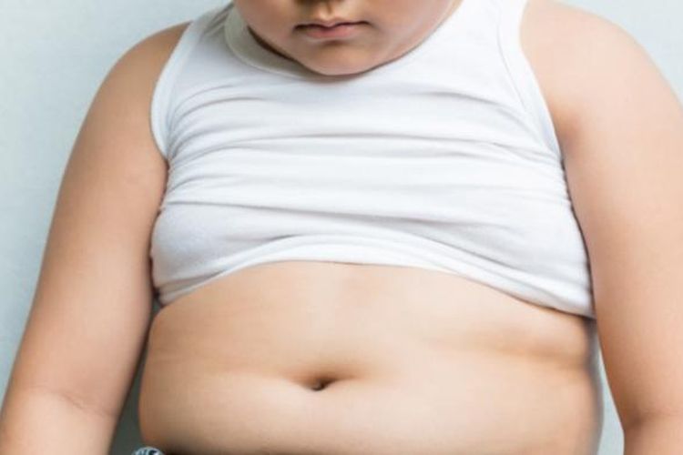 Ilustrasi obesitas pada anak.

