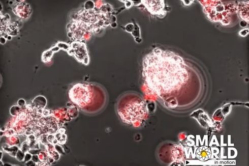 Video 23 Detik Tunjukkan Ganasnya Virus Corona Bunuh Sel Otak