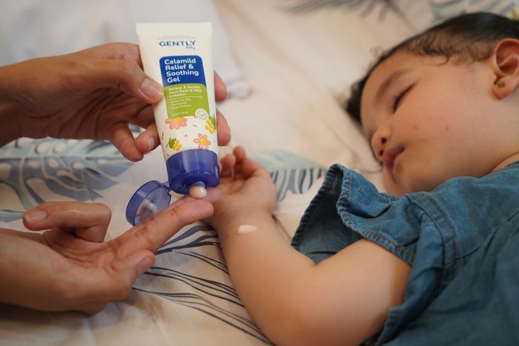 Cuaca Panas Picu Biang Keringat pada Anak, Ini Solusinya