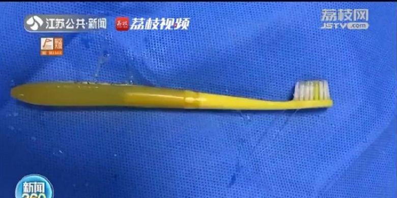Inilah sikat gigi yang ditelan seorang pria di Provinsi Jiangsu, China.