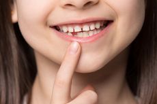 3 Cara Mengatasi Gigi Kecil