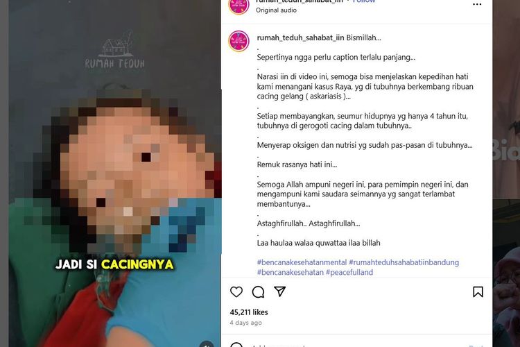 Raya, bocah berusia tiga tahun asal Kampung Padangenyang, Desa Cianaga, Kecamatan Kabandungan, Kabupaten Sukabumi, Jawa Barat, meninggal dengan tubuh dipenuhi cacing.