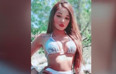 Ibu dan Anak Lakukan Operasi Pengencangan Bokong Ilegal, Wanita ...