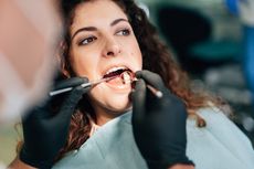 9 Perawatan Gigi yang Ditanggung BPJS Kesehatan