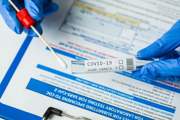 Ilustrasi tes swab Covid-19 untuk mendeteksi infeksi virus corona untuk hentikan pandemi Covid-19.(Shutterstock)