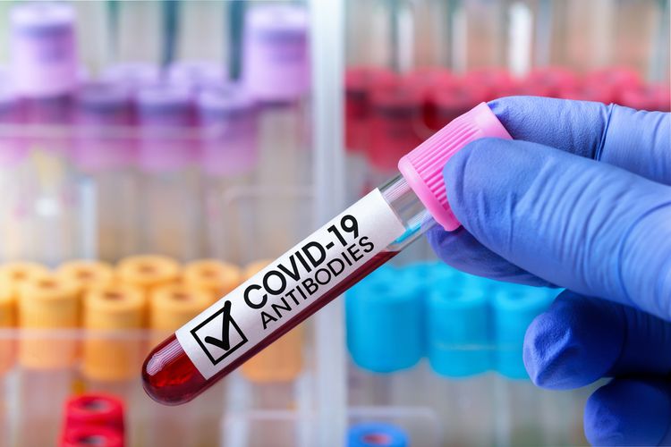 Ilustrasi tes antibodi terhadap SARS-CoV-2. Ilmuwan temukan antibodi Covid-19 masih ada di tubuh penyintas hingga 10 bulan setelah terinfeksi.