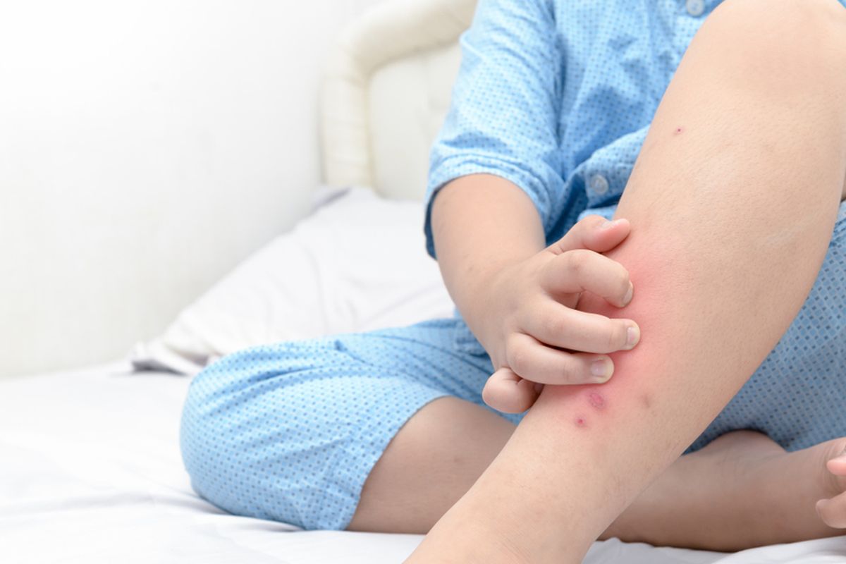 Gejala ringworm atau kurap salah satunya adalah gatal pada tubuh.