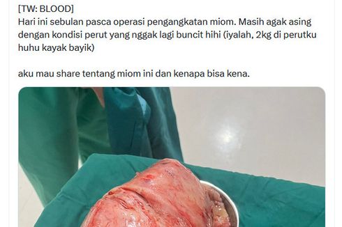 Kisah Anisa Idap Miom 2 Kg, Awalnya Benjolan Kecil dan Rahim Sempat Akan Diangkat