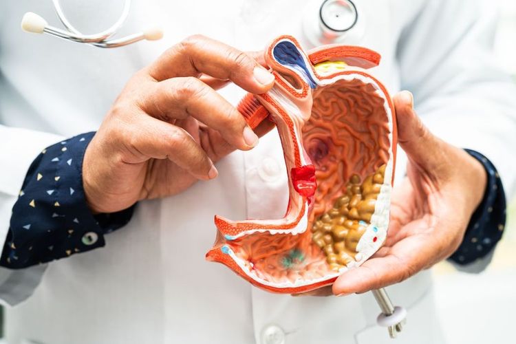 4 Bagian Lambung pada Manusia: Apa Fungsi Fundus?
