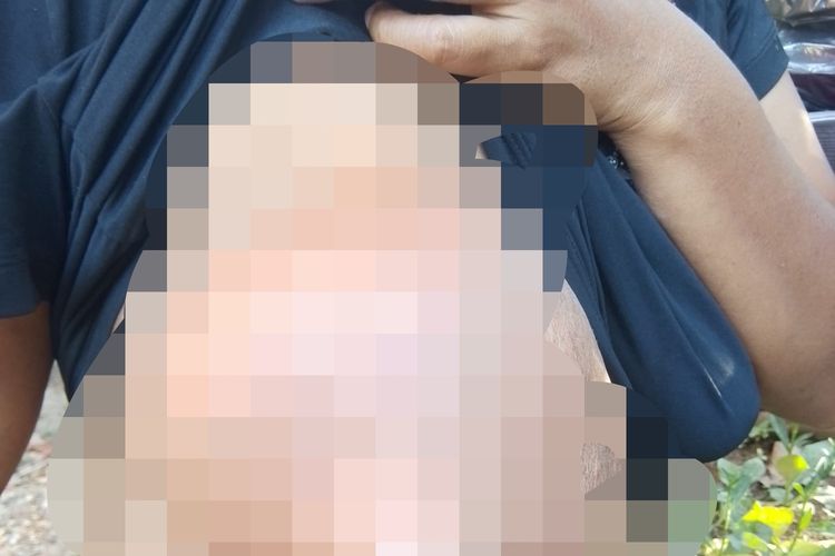 Di Tengah Pemulihan Gempa Flores, Emirensiana Berjuang Melawan Kanker Payudara