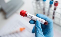 Dinkes Tambah 3 Lokasi Perawatan Dukungan Pengobatan HIV/AIDS di Tangsel