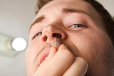 Pelindung yang Terabaikan: Memahami Fungsi Bulu Hidung dan Bulu Tubuh