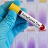 Infeksi Toksoplasma: Gejala, Penyebab, Cara Mencegah
