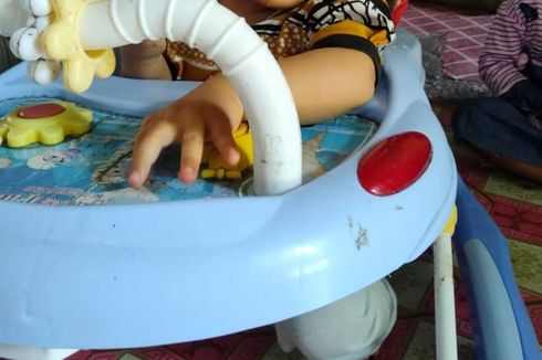 Kisah Piola, Bayi 9 Bulan yang Hidup Tanpa Anus dan Butuh Pertolongan