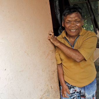 Felix (65), Orang yang Pernah Mengalami Kusta difoto saat berada di rumah kakaknya, di Kelurahan Pandu, Kecamatan Bunaken, Manado.