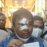 Polisi Dalami Dugaan Keterlibatan Pihak Lain dalam Pengeroyokan Ketua KNPI Haris Pertama