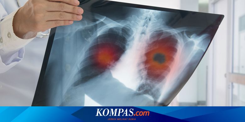 Adakah Makanan Pembersih Paru Paru Halaman All Kompas Com