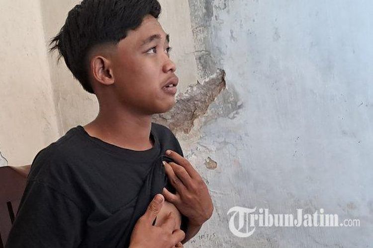 Korban selamat Tragedi Kanjuruhan, Nur Saguanto menunjukkan luka di dada yang mengalami pembengkakan 