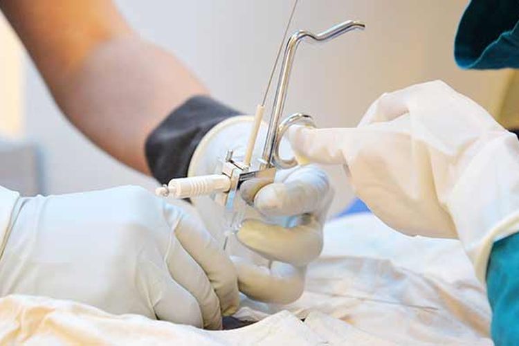 Proses Brachytherapy (Dok. St. Stamford Modern Cancer Hospital)