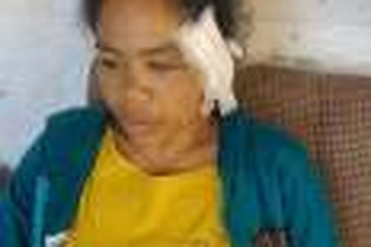Tuwa Negu seorang ibu rumah tangga sal Desa Modu Waimaringu, Kecamatan Kota Waikabubak, Kabupaten Sumba Barat, Nusa Tenggara Timur (NTT), yang menjadi korban panganiayaan dengan menggunakan parang oleh empat orang pelaku