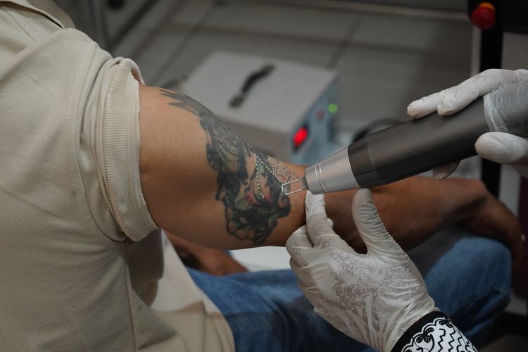41 Warga di Situbondo Hapus Tato, Kapolres Situbondo: Gratis