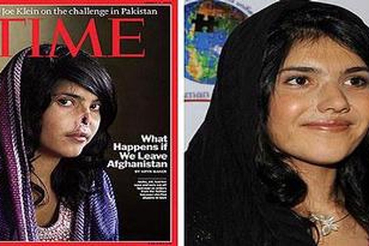 Aisha, 19 tahun, di sampul majalah Time sebelum operasi (kiri) dan setelah pemasangan hidung palsu (kanan)