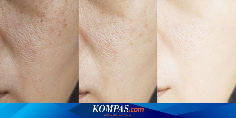 7 Penyebab Kulit Kusam Dan Kiat Mengatasinya Halaman All Kompas Com