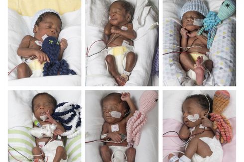 Wanita AS Lahirkan Bayi Kembar Enam, Ini Penjelasan Ilmiahnya