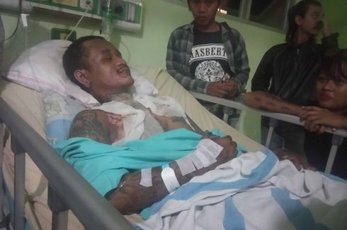 Alami Luka Bakar 30 Persen, Anak Punk Korban Pengeroyokan dan Pembakaran Mulai Membaik