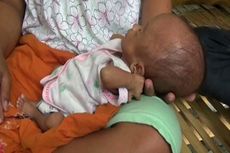 Di Rumah Berdinding Koran, Bayi Hidrosefalus Tergolek Tanpa Perawatan Medis