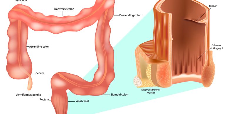 Wasir merupakan gangguan yang terjadi pada organ